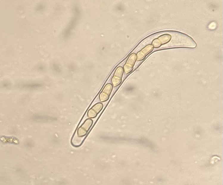 Venturia inaequalis ascospores under a microscope.